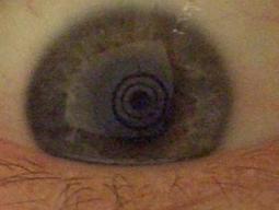 improvisiertes Keratoskop - gesundes Auge (r) improvisiertes Keratoskop - gesundes Auge (r)